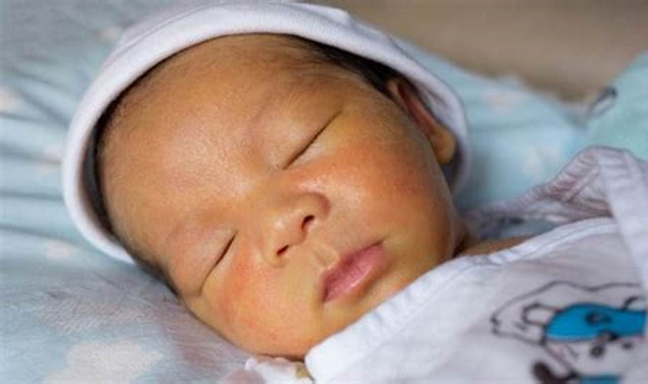 Cara Mengatasi Bayi Kuning